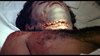 A close-up of a man's bloodied neck and chest, as seen on the "Dead of Night (1974) DVD," recalls chilling scenes from vintage horror films.